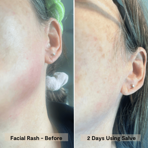 Hydration Repair Honey Salve